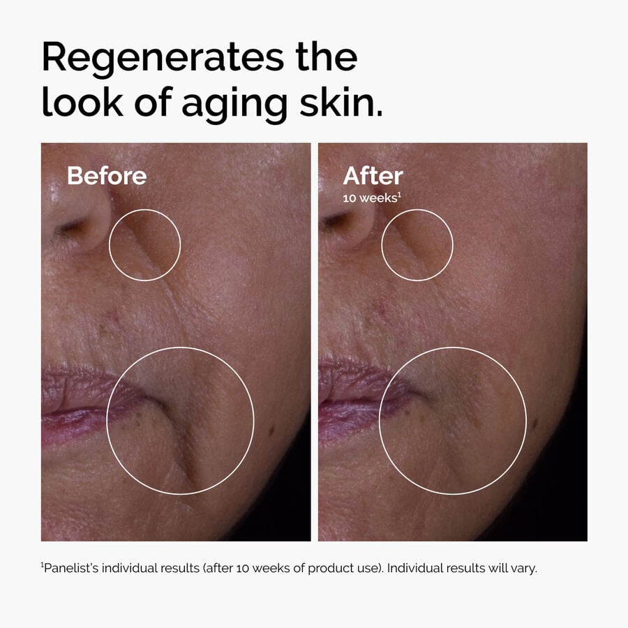 GF 15% Solution - Skin Reset
