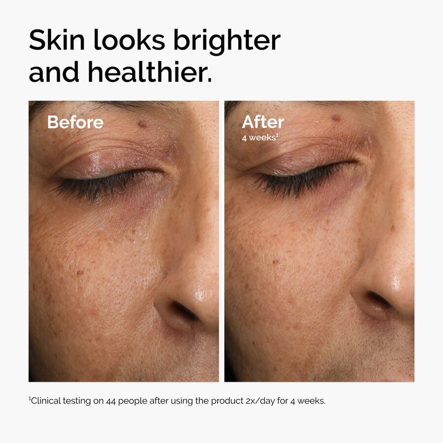 Multi-Antioxidant Radiance Serum - Bright Care